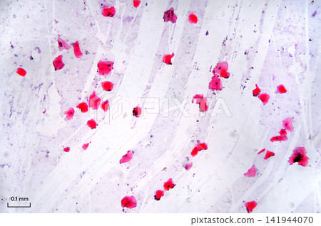 Human cell mucous membrane (smear) under light microscope. Layer of cells scraped from moist inner lining of the human body. Stained. 10X objective with 2X adapter, and scale with length in mm. Photo Human cell mucous membrane (smear) under light microscope. Layer of cells scraped from moist inner lining of the human body. Stained. 10X objective with 2X adapter, and scale with length in mm. Photo 141944070