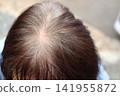 Thinning hair and graying hair on the crown of the head and scalp in senior women. 141955872