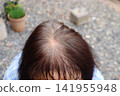Close-up of thinning hair and gray hair on the crown of a senior woman's head, where the scalp is visible. 141955948