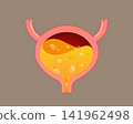 Foamy Urine and Bubbles in Urinary Bladder, Medical Anatomy Illustration 141962498