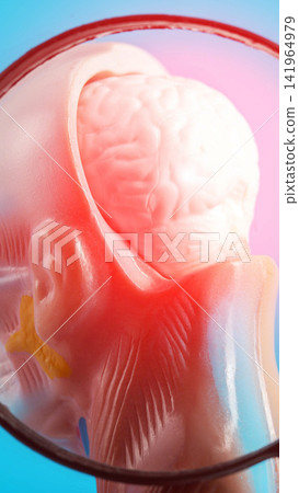 Anatomical model of the human brain with a prominent red area indicating pain or inflammation, viewed through a circular magnifying glass, vertical photograph used in medical education, sclerosis Anatomical model of the human brain with a prominent red area indicating pain or inflammation, viewed through a circular magnifying glass, vertical photograph used in medical education, sclerosis 141964979