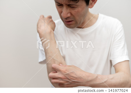一位中年男子因手臂奇癢難耐而抓癢至皮開肉綻。癢死了,真癢。 一位中年男子因手臂奇癢難耐而抓癢至皮開肉綻。癢死了,真癢。 141977024