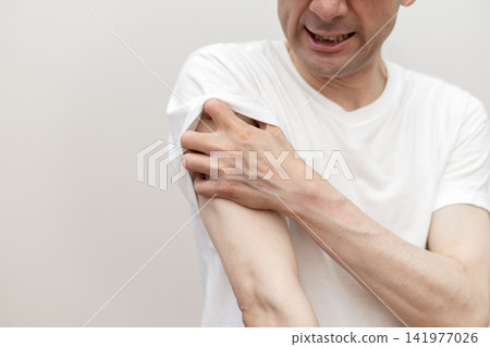 A middle-aged man is scratching his arm raw due to severe itching. Itchy, itchy. A middle-aged man is scratching his arm raw due to severe itching. Itchy, itchy. 141977026