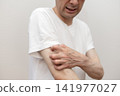 A middle-aged man is scratching his arm raw due to severe itching. Itchy, itchy. 141977027