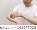 A middle-aged man is scratching his arm raw due to severe itching. Itchy, itchy. 141977028