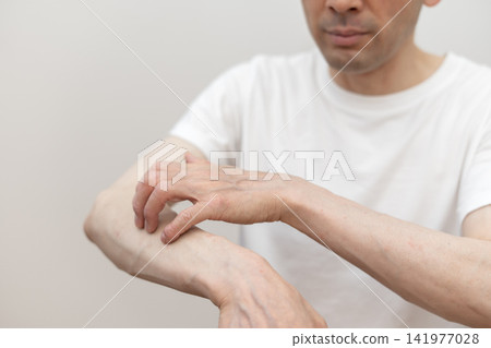 一位中年男子因手臂奇癢難耐而抓癢至皮開肉綻。癢死了,真癢。 一位中年男子因手臂奇癢難耐而抓癢至皮開肉綻。癢死了,真癢。 141977028