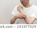 A middle-aged man is scratching his arm raw due to severe itching. Itchy, itchy. 141977029