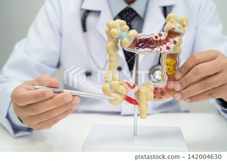 Intestine, doctor holding human anatomy model for study diagnosis and treatment in hospital. Intestine, doctor holding human anatomy model for study diagnosis and treatment in hospital. 142004630