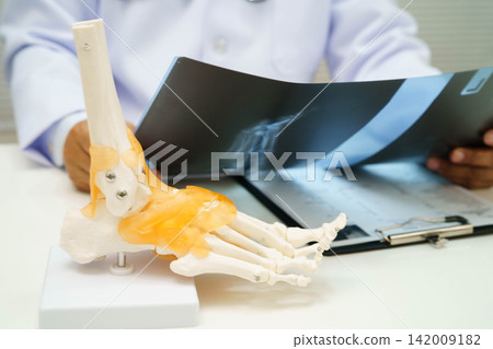 Doctor examining foot ankle joint bone radiography xray film. Doctor examining foot ankle joint bone radiography xray film. 142009182