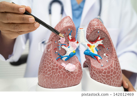 Pneumonia, lung cancer, Asian doctor with human lung model. Pneumonia, lung cancer, Asian doctor with human lung model. 142012469