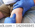 Doctor examining child with bodily red rash. Kid allergy closeup. Little baby scratches an eruption. Nurse applies special cream to atopic skin. Dermatitis, irritation, hive. Pruritus. Mosquito bites 142048845