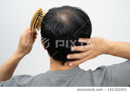 Bald in the middle head and begin no loss hair glabrous of mature man. Bald in the middle head and begin no loss hair glabrous of mature man. 142102001