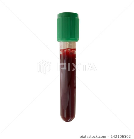 Green cap blood collection tube filled with blood sample isolated on white background Green cap blood collection tube filled with blood sample isolated on white background 142106502