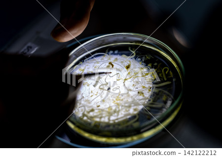 Freshwater Trematode Parasites: Clinostomum, Postorchigenes and Thapariella spp. for education in Lab. Freshwater Trematode Parasites: Clinostomum, Postorchigenes and Thapariella spp. for education in Lab. 142122212