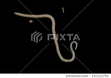 Freshwater Trematode Parasites: Clinostomum, Postorchigenes and Thapariella spp. for education in Lab. Freshwater Trematode Parasites: Clinostomum, Postorchigenes and Thapariella spp. for education in Lab. 142122758