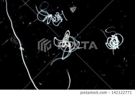 Freshwater Trematode Parasites: Clinostomum, Postorchigenes and Thapariella spp. for education in Lab. Freshwater Trematode Parasites: Clinostomum, Postorchigenes and Thapariella spp. for education in Lab. 142122771