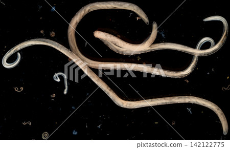 Freshwater Trematode Parasites: Clinostomum, Postorchigenes and Thapariella spp. for education in Lab. Freshwater Trematode Parasites: Clinostomum, Postorchigenes and Thapariella spp. for education in Lab. 142122775