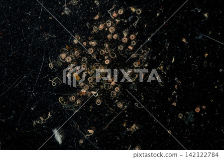 Freshwater Trematode Parasites: Clinostomum, Postorchigenes and Thapariella spp. for education in Lab. Freshwater Trematode Parasites: Clinostomum, Postorchigenes and Thapariella spp. for education in Lab. 142122784