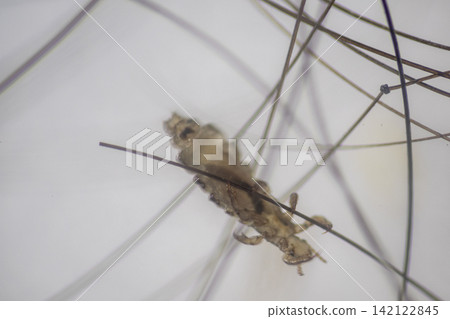Human Head Louse and Nits (Pediculus humanus capitis) Attached to Human Hair Under Microscope | Microscopic Close-Up of Lice Infestation. Human Head Louse and Nits (Pediculus humanus capitis) Attached to Human Hair Under Microscope | Microscopic Close-Up of Lice Infestation. 142122845
