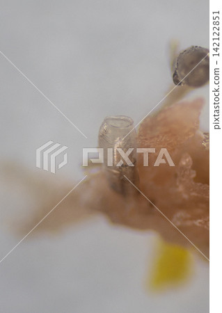Human Head Louse and Nits (Pediculus humanus capitis) Attached to Human Hair Under Microscope | Microscopic Close-Up of Lice Infestation. Human Head Louse and Nits (Pediculus humanus capitis) Attached to Human Hair Under Microscope | Microscopic Close-Up of Lice Infestation. 142122851