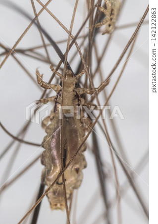 Human Head Louse and Nits (Pediculus humanus capitis) Attached to Human Hair Under Microscope | Microscopic Close-Up of Lice Infestation. 142122863