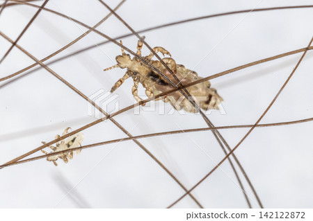 Human Head Louse and Nits (Pediculus humanus capitis) Attached to Human Hair Under Microscope | Microscopic Close-Up of Lice Infestation. 142122872