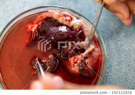 Freshwater Trematode Parasites: Clinostomum, Postorchigenes and Thapariella spp. for education in Lab. Freshwater Trematode Parasites: Clinostomum, Postorchigenes and Thapariella spp. for education in Lab. 142122928