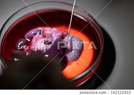 Freshwater Trematode Parasites: Clinostomum, Postorchigenes and Thapariella spp. for education in Lab. Freshwater Trematode Parasites: Clinostomum, Postorchigenes and Thapariella spp. for education in Lab. 142122933