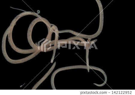 Freshwater Trematode Parasites: Clinostomum, Postorchigenes and Thapariella spp. for education in Lab. Freshwater Trematode Parasites: Clinostomum, Postorchigenes and Thapariella spp. for education in Lab. 142122952