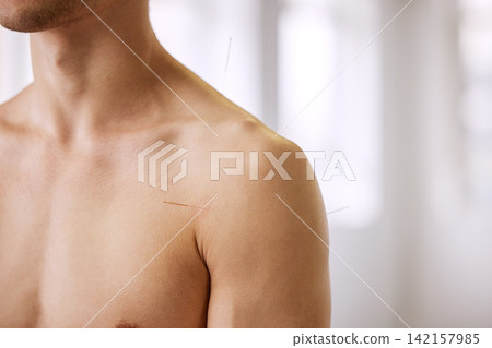 Acupuncture, man and treatment of body for healthcare, healing muscle or relief from back pain. Healthy, patient and physiotherapy with dry needling to relax nervous system, injury or holistic care Acupuncture, man and treatment of body for healthcare, healing muscle or relief from back pain. Healthy, patient and physiotherapy with dry needling to relax nervous system, injury or holistic care 142157985