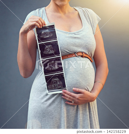 Woman, pregnant and child ultrasound in studio for maternity shoot, album and baby shower. Mother, expecting and sonogram isolated on gray background for gender reveal, surrogacy and legal adoption Woman, pregnant and child ultrasound in studio for maternity shoot, album and baby shower. Mother, expecting and sonogram isolated on gray background for gender reveal, surrogacy and legal adoption 142158229