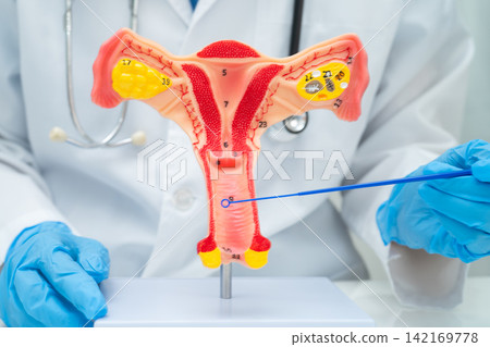 Doctor holding human uterus model for vaginal and cervix pap smear check up in the obstetrics and gynecology. Doctor holding human uterus model for vaginal and cervix pap smear check up in the obstetrics and gynecology. 142169778