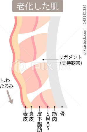 Supporting ligaments in aging skin: their mechanism Supporting ligaments in aging skin: their mechanism 142181325