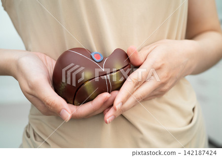 Cirrhosis, Liver cancer, fatty liver, Asian women with liver human anatomy model in World Hepatitis Day. 142187424