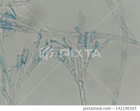 Close-up of Penicillium conidia Close-up of Penicillium conidia 142190305
