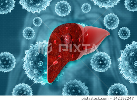 Virus infected human liver Virus infected human liver 142192247
