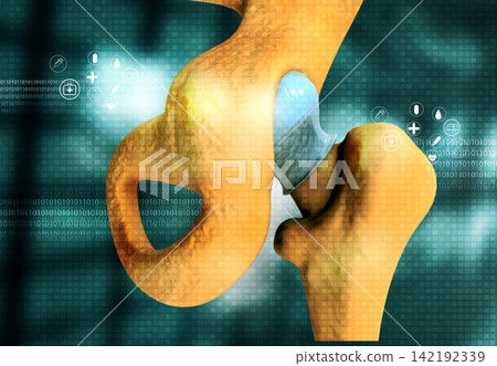Knee replacement on medical background Knee replacement on medical background 142192339