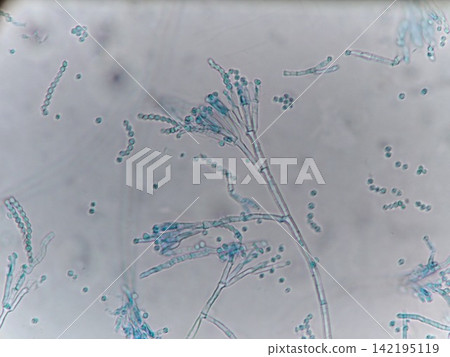Conidia dyed a beautiful cotton blue Conidia dyed a beautiful cotton blue 142195119