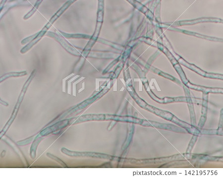 The mycelium is growing rapidly. The mycelium is growing rapidly. 142195756
