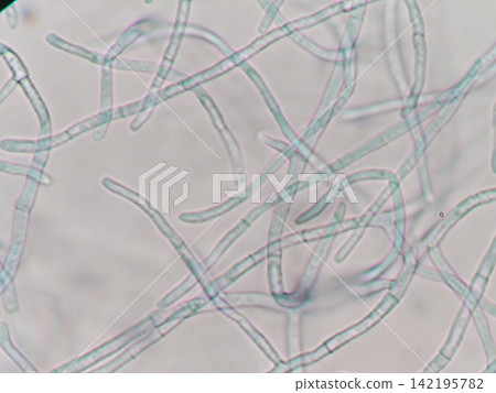 The appearance of the tip of the mycelium growing. 142195782