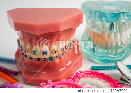 Orthodontic ligatures rings and ties, elastic rubber bands on orthodontic braces, model for dentist studying about dentistry. Orthodontic ligatures rings and ties, elastic rubber bands on orthodontic braces, model for dentist studying about dentistry. 142197661