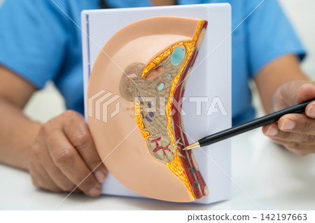 doctor holding female breast human anatomy model. doctor holding female breast human anatomy model. 142197663