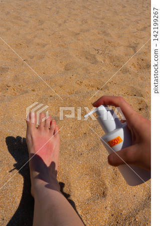 Sunburn on a girl's leg on the beach, skincare for summer holiday in South Korea Sunburn on a girl's leg on the beach, skincare for summer holiday in South Korea 142199267