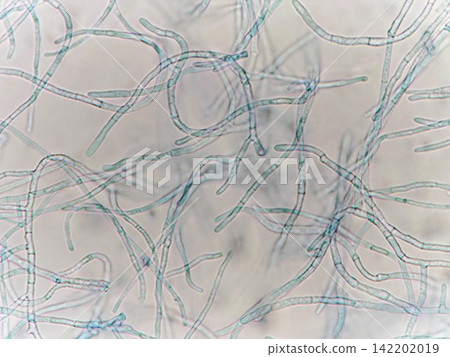 Observation of the tips of mycelium Observation of the tips of mycelium 142202019