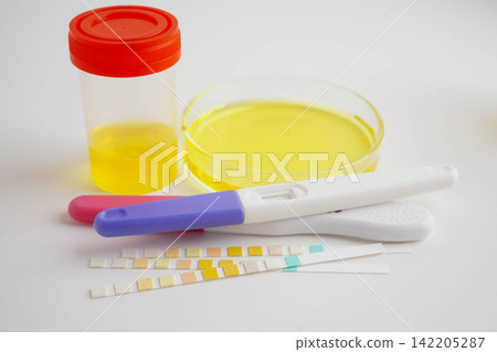 Urinalysis, urine cup with reagent strip pH paper test and comparison chart in laboratory. Urinalysis, urine cup with reagent strip pH paper test and comparison chart in laboratory. 142205287