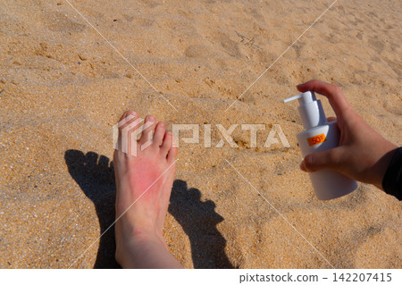 Sunburn on a girl's leg on the beach, skincare for summer holiday in South Korea Sunburn on a girl's leg on the beach, skincare for summer holiday in South Korea 142207415