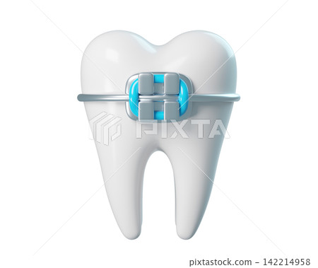 3d Tooth with a braces, bracket frame, realistic render icon isolated. Infographics installation of corrective brace 3d Tooth with a braces, bracket frame, realistic render icon isolated. Infographics installation of corrective brace 142214958