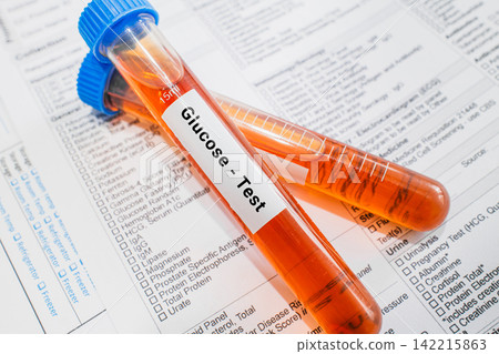 blood sample in lab test tube for Glucose test blood sample in lab test tube for Glucose test 142215863