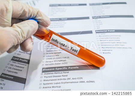 blood sample in lab test tube for Influenza test blood sample in lab test tube for Influenza test 142215865
