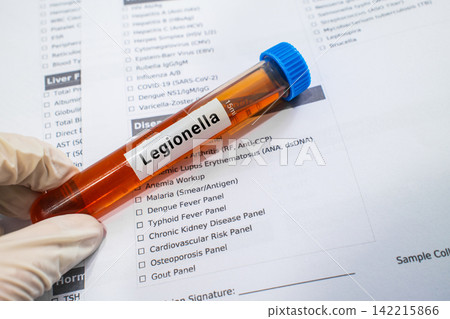 blood sample in lab test tube for Legionella test blood sample in lab test tube for Legionella test 142215866